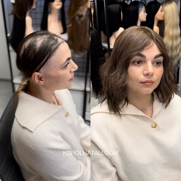 Хіміотерапія та перуки Korol Natali